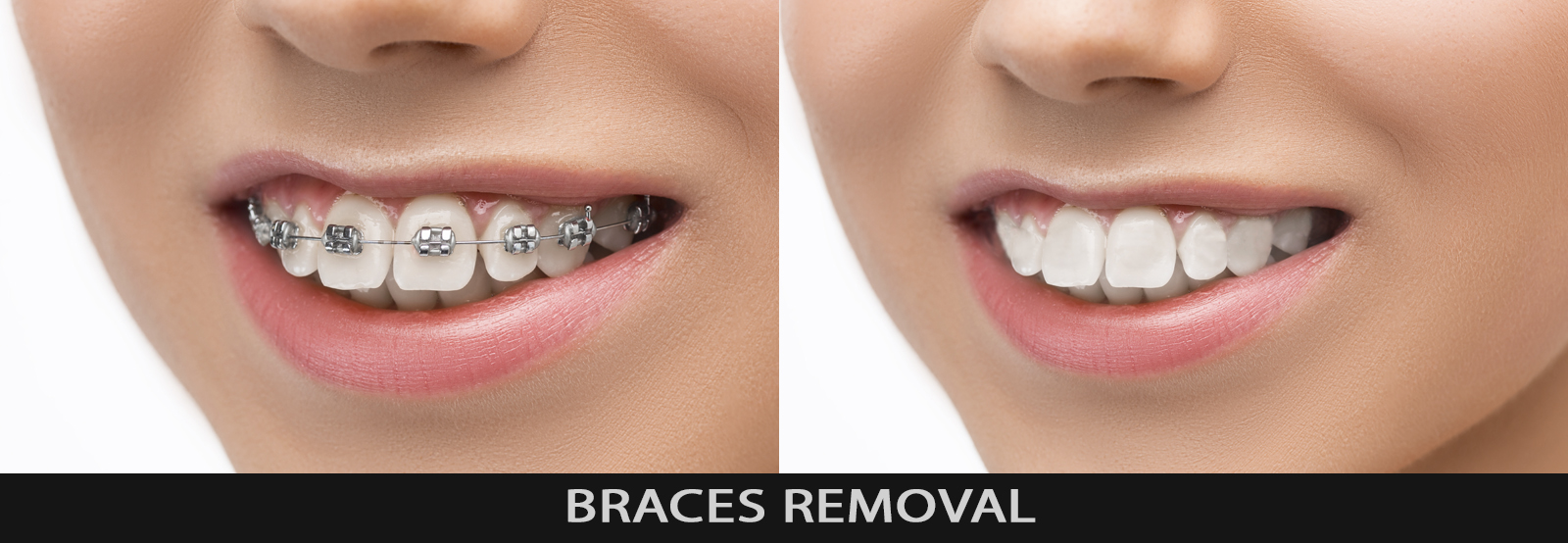 Portrait photographix